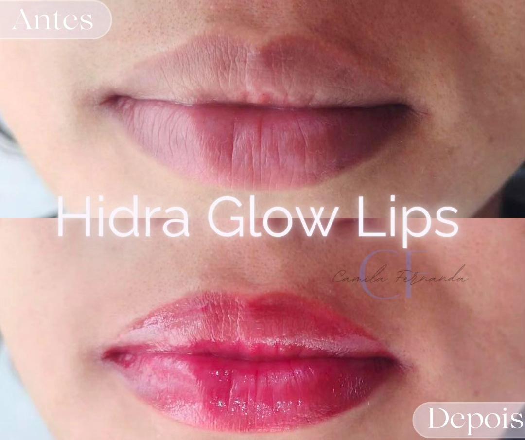 Hidra Glow Lips