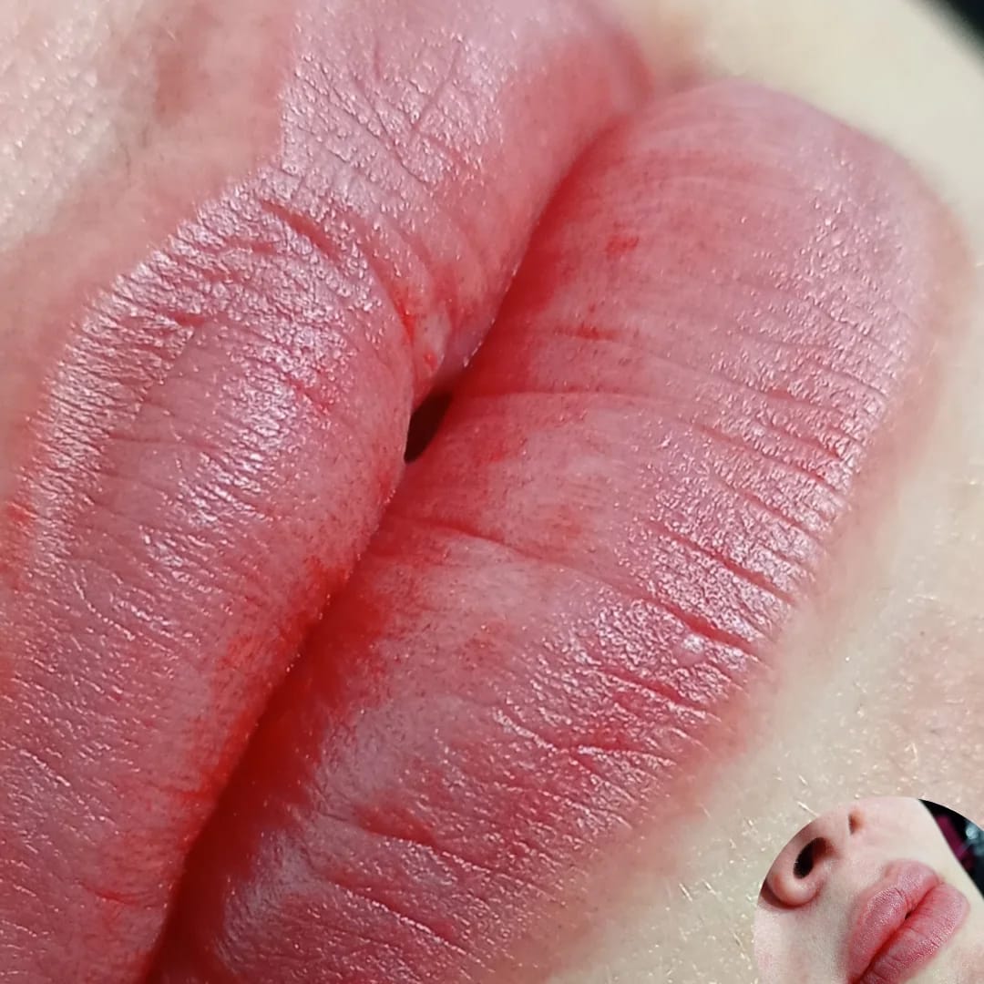 Micro Labial
